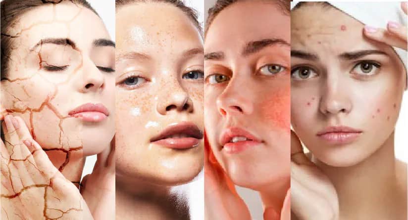 انواع پوست و ویژگی‌های آن
